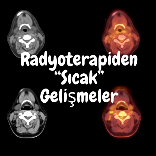 Radyoterapiden “Sıcak” Gelişmeler_